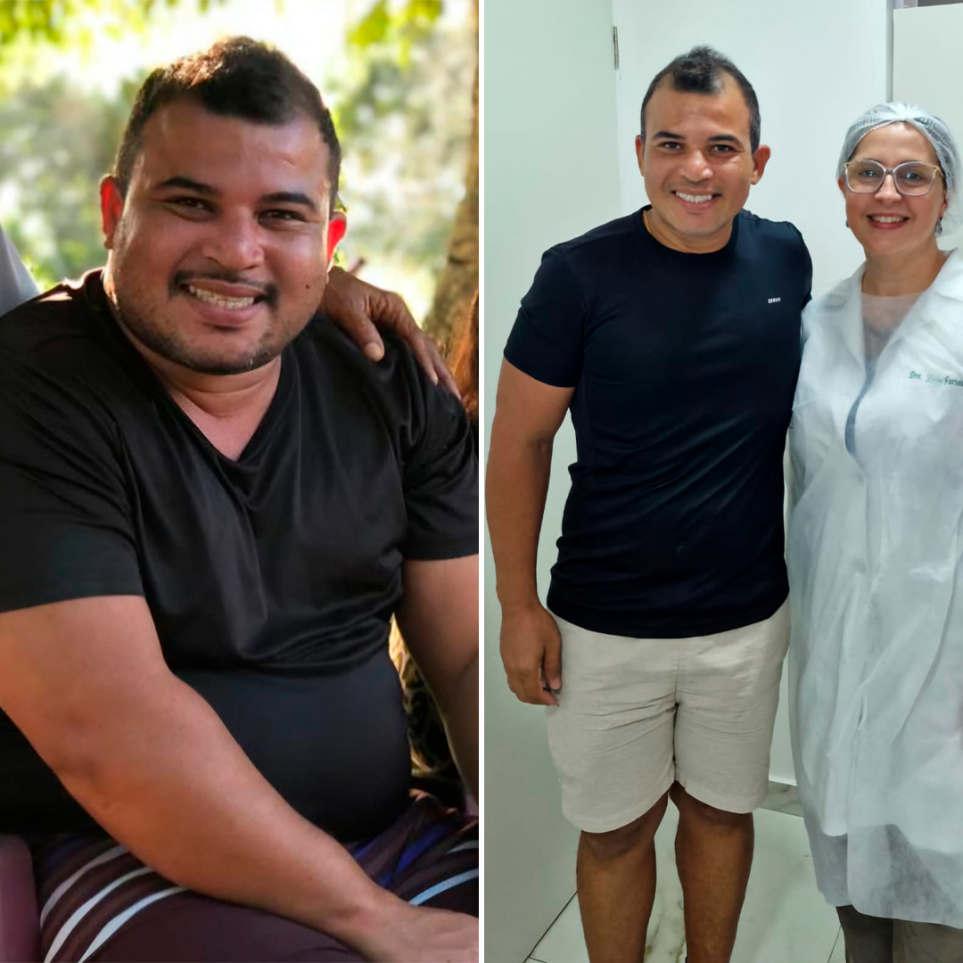 Comparacao-1